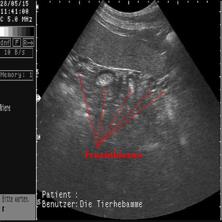 Ultraschall Tanisha